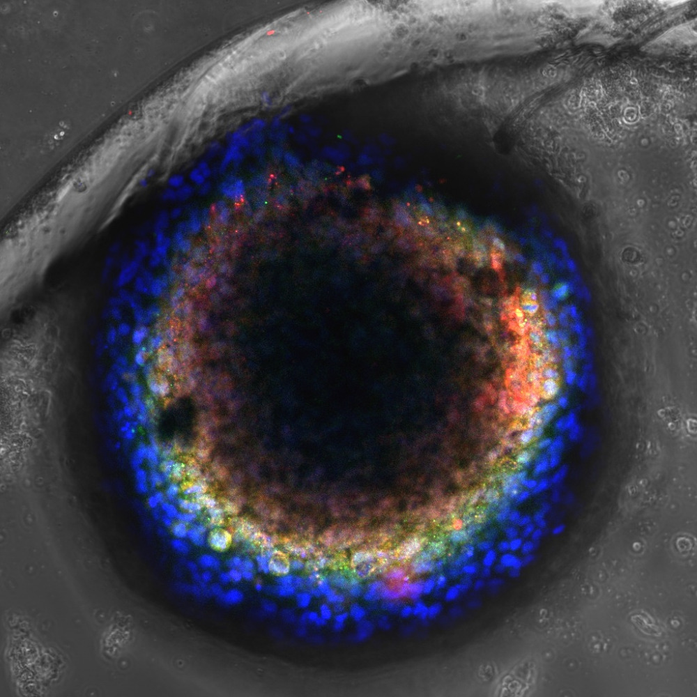 Organoid Zonation